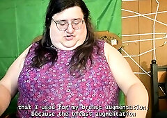 How Lengthy Does Post Surgery Exhaustion Final?