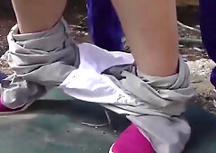 001-youth-with-areare-apd