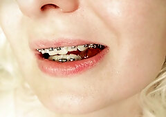 Braces fetish - MUKBANG eating ASMR video... food fetish