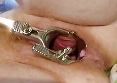 Need larger speculum