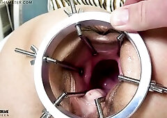 Greater quantity Fisting Exploration